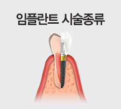 öƮ ü