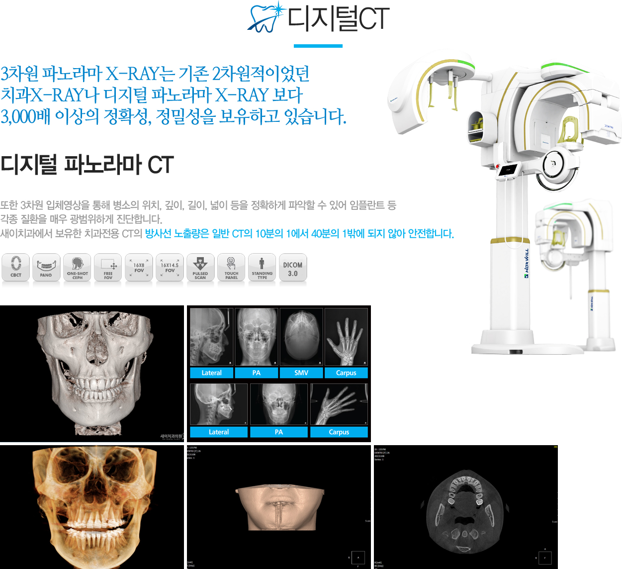 ĳ CT

3 ĳ X-RAY  2̾ ġX-RAY  ĳ X-RAY   3,000 ̻ Ȯ, м ϰ ֽϴ. 

 3 ü   ġ, , ,   Ȯϰ ľ  ־ öƮ   ȯ ſ ϰ մϴ.

ġ  ġ CT 缱 ⷮ Ϲ CT 10 1 40 1ۿ  ʾ մϴ.
